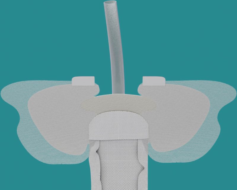 Qivi FEC Female External Urine Management Device Consure Medical