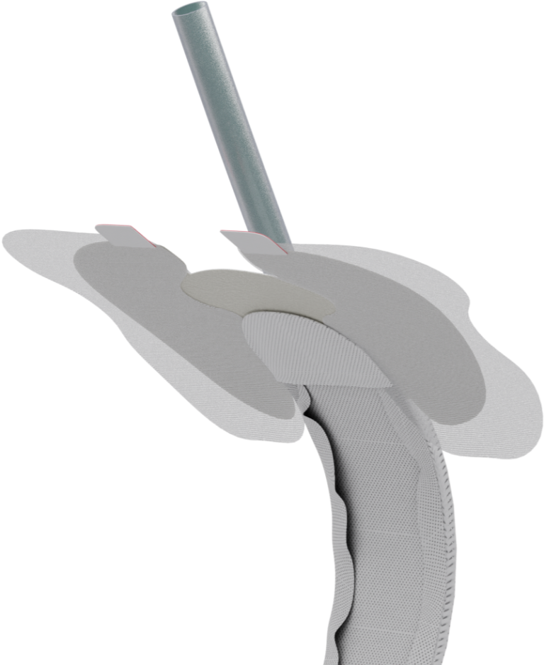 Qivi FEC Female External Urine Management Device Consure Medical