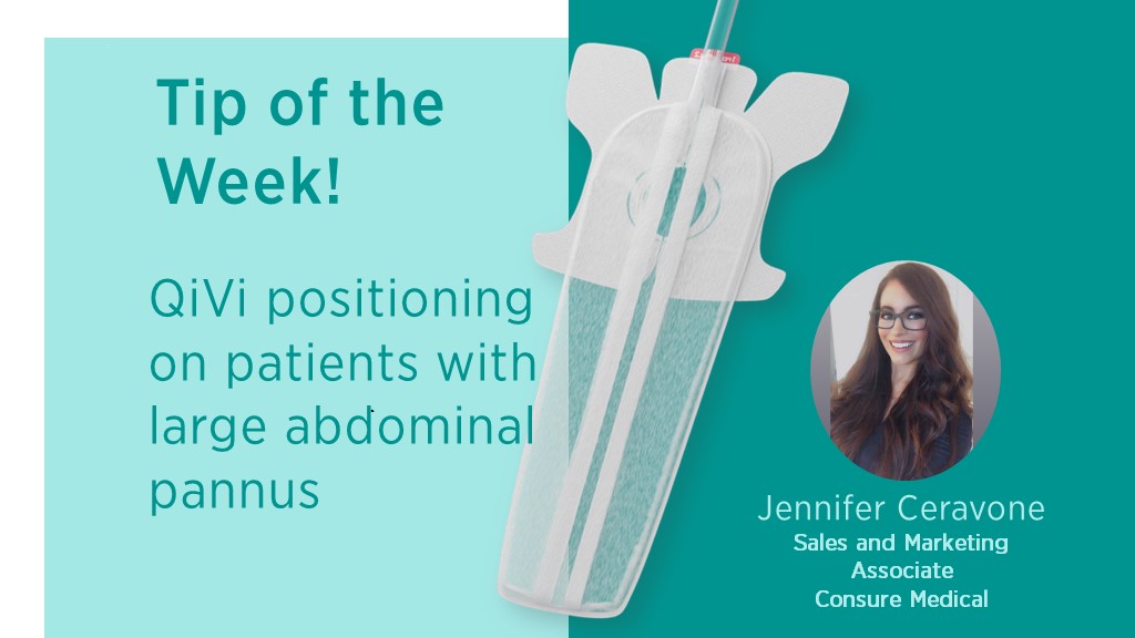Consure Medical - QiVi Tip of the Week - Patients with large abdominal pannus