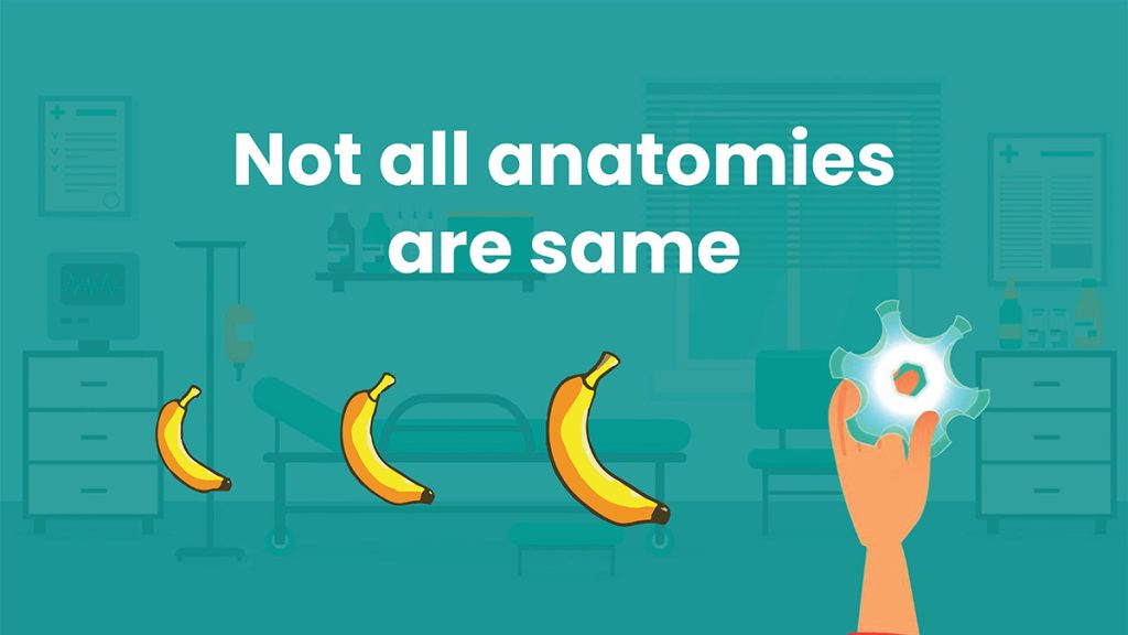 How Do You Size a Male External Catheter? Consure Medical