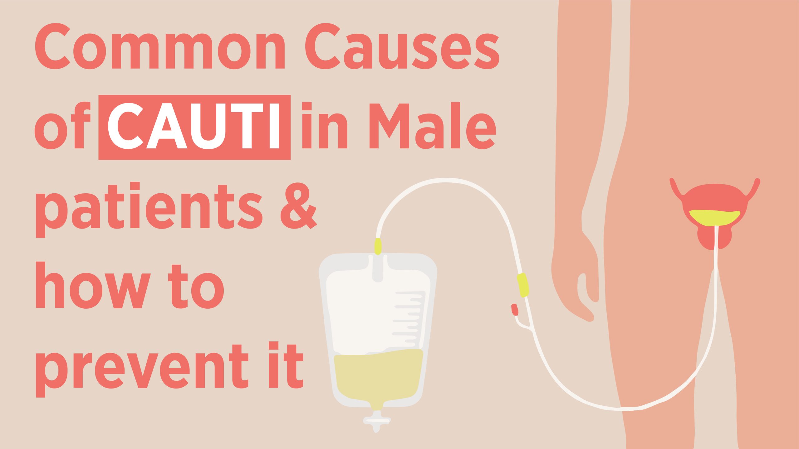 Causes of Male CAUTI and How To Prevent It