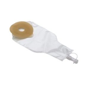 External Anal Pouch for Fecal Incontinence