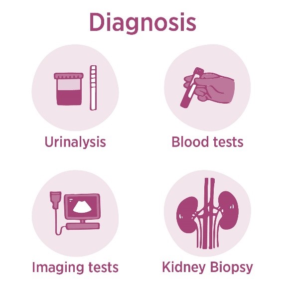 Tests diagnosing acute kidney injury