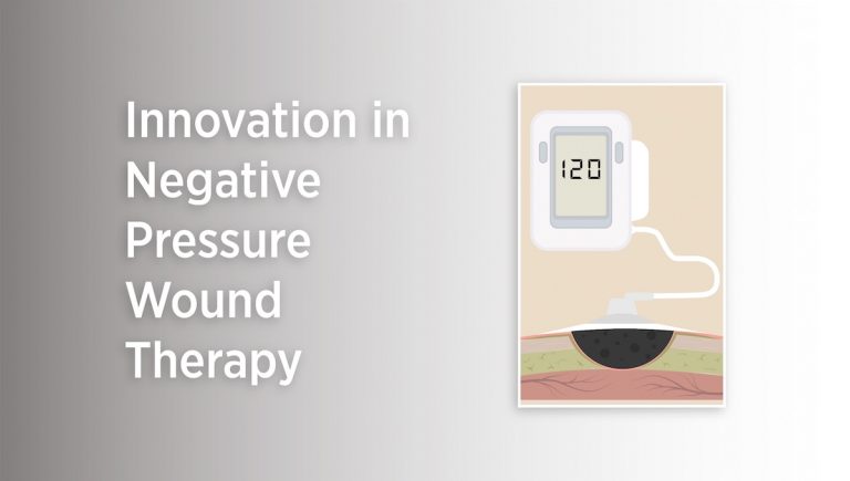 Innovations in negative pressure therapy
