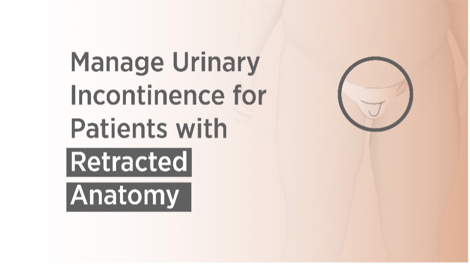 Male Urinary Incontinence Patients with Retracted Anatomy